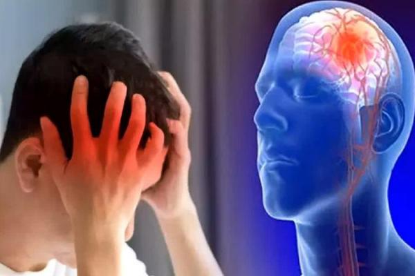 Cara Mencegah Stroke Sejak Usia Muda